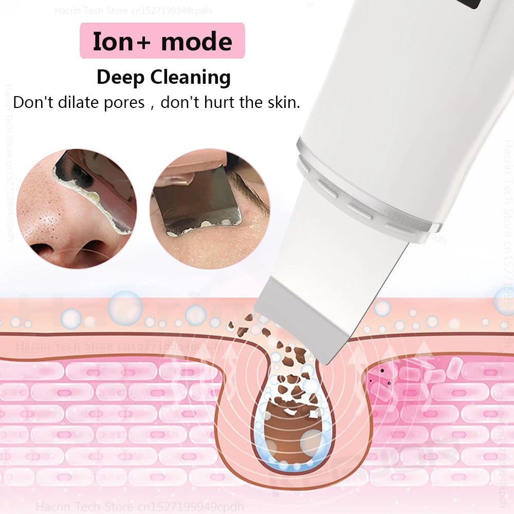 Ultrasonic Skin Scrubber Peeling Blackhead Remover Facial Spatula Deep Face Cleaning Pore Cleaner Facial Shovel Cleanser