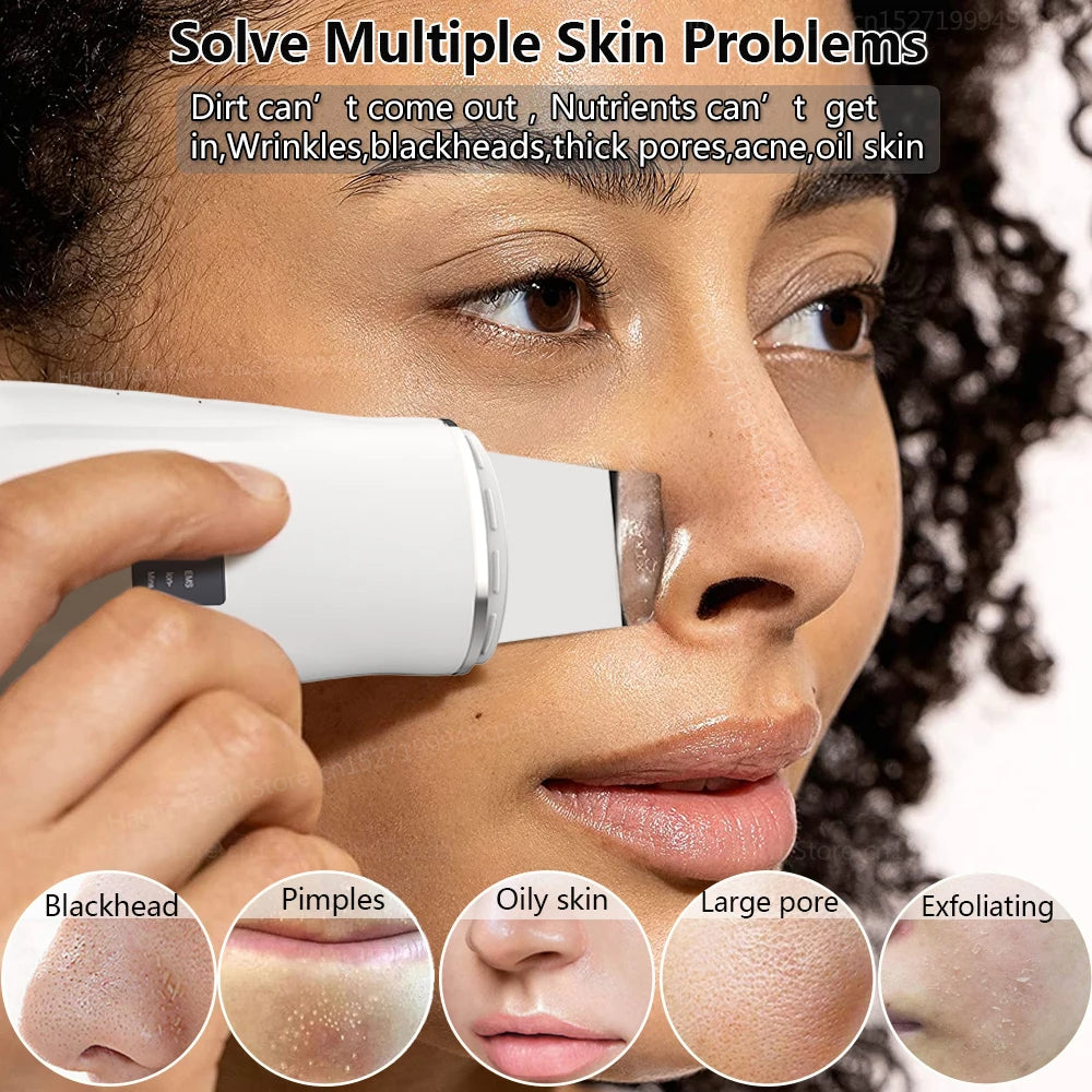 Ultrasonic Skin Scrubber Peeling Blackhead Remover Facial Spatula Deep Face Cleaning Pore Cleaner Facial Shovel Cleanser