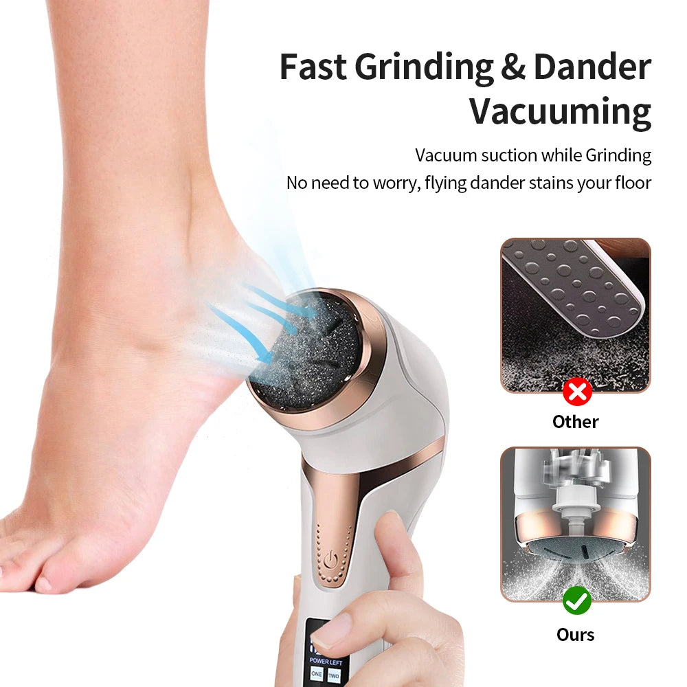 2024 Electric Foot Grinder Files, Portable Feet Callus Remover Foot Care Tool for Dead Hard Skin Rechargeable Pedicure Tools