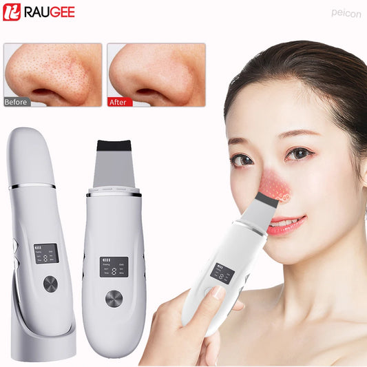 Ultrasonic Skin Scrubber Peeling Blackhead Remover Facial Spatula Deep Face Cleaning Pore Cleaner Facial Shovel Cleanser